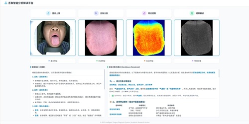 舌诊智能识别系统